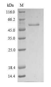 (Tris-Glycine gel) Discontinuous SDS-PAGE (reduced) with 5% enrichment gel and 15% separation gel. (Tris-Glycine gel) Discontinuous SDS-PAGE (reduced) with 5% enrichment gel and 15% separation gel.
