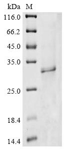 (Tris-Glycine gel) Discontinuous SDS-PAGE (reduced) with 5% enrichment gel and 15% separation gel. (Tris-Glycine gel) Discontinuous SDS-PAGE (reduced) with 5% enrichment gel and 15% separation gel.