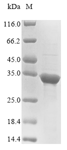 Recombinant Human YjeF N-terminal domain-containing protein 3 (YJEFN3) - image 1