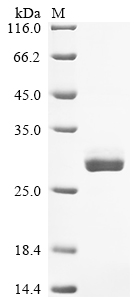 (Tris-Glycine gel) Discontinuous SDS-PAGE (reduced) with 5% enrichment gel and 15% separation gel. (Tris-Glycine gel) Discontinuous SDS-PAGE (reduced) with 5% enrichment gel and 15% separation gel.