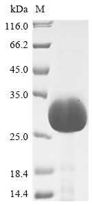 (Tris-Glycine gel) Discontinuous SDS-PAGE (reduced) with 5% enrichment gel and 15% separation gel. (Tris-Glycine gel) Discontinuous SDS-PAGE (reduced) with 5% enrichment gel and 15% separation gel.