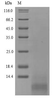 (Tris-Glycine gel) Discontinuous SDS-PAGE (reduced) with 5% enrichment gel and 15% separation gel. (Tris-Glycine gel) Discontinuous SDS-PAGE (reduced) with 5% enrichment gel and 15% separation gel.