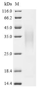 Recombinant Dog Lysozyme C, milk isozyme - image 1