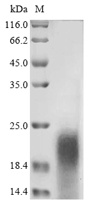 Recombinant Macrovipera lebetina obtusa Disintegrin obtustatin - image 1