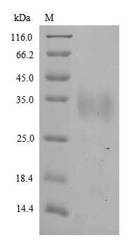 (Tris-Glycine gel) Discontinuous SDS-PAGE (reduced) with 5% enrichment gel and 15% separation gel. (Tris-Glycine gel) Discontinuous SDS-PAGE (reduced) with 5% enrichment gel and 15% separation gel.