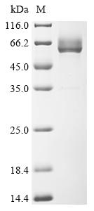 Recombinant Streptococcus pneumoniae serotype 2 Pneumolysin (ply) - image 1
