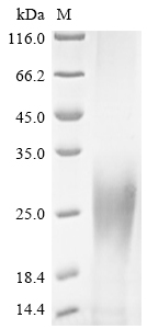 (Tris-Glycine gel) Discontinuous SDS-PAGE (reduced) with 5% enrichment gel and 15% separation gel. (Tris-Glycine gel) Discontinuous SDS-PAGE (reduced) with 5% enrichment gel and 15% separation gel.