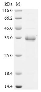 (Tris-Glycine gel) Discontinuous SDS-PAGE (reduced) with 5% enrichment gel and 15% separation gel.
