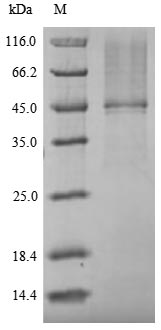 (Tris-Glycine gel) Discontinuous SDS-PAGE (reduced) with 5% enrichment gel and 15% separation gel. (Tris-Glycine gel) Discontinuous SDS-PAGE (reduced) with 5% enrichment gel and 15% separation gel.