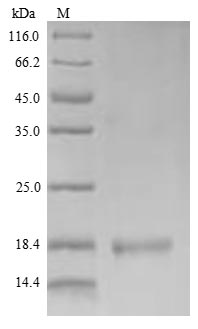 (Tris-Glycine gel) Discontinuous SDS-PAGE (reduced) with 5% enrichment gel and 15% separation gel. (Tris-Glycine gel) Discontinuous SDS-PAGE (reduced) with 5% enrichment gel and 15% separation gel.