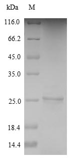 (Tris-Glycine gel) Discontinuous SDS-PAGE (reduced) with 5% enrichment gel and 15% separation gel. (Tris-Glycine gel) Discontinuous SDS-PAGE (reduced) with 5% enrichment gel and 15% separation gel.