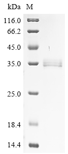 Recombinant 1-phosphatidylinositol phosphodiesterase - image 1