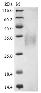 (Tris-Glycine gel) Discontinuous SDS-PAGE (reduced) with 5% enrichment gel and 15% separation gel. (Tris-Glycine gel) Discontinuous SDS-PAGE (reduced) with 5% enrichment gel and 15% separation gel.