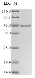 (Tris-Glycine gel) Discontinuous SDS-PAGE (reduced) with 5% enrichment gel and 15% separation gel. (Tris-Glycine gel) Discontinuous SDS-PAGE (reduced) with 5% enrichment gel and 15% separation gel.