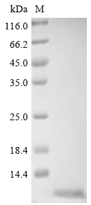 (Tris-Glycine gel) Discontinuous SDS-PAGE (reduced) with 5% enrichment gel and 15% separation gel. (Tris-Glycine gel) Discontinuous SDS-PAGE (reduced) with 5% enrichment gel and 15% separation gel.