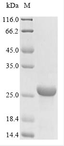 (Tris-Glycine gel) Discontinuous SDS-PAGE (reduced) with 5% enrichment gel and 15% separation gel. (Tris-Glycine gel) Discontinuous SDS-PAGE (reduced) with 5% enrichment gel and 15% separation gel.
