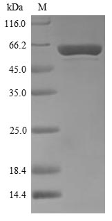 (Tris-Glycine gel) Discontinuous SDS-PAGE (reduced) with 5% enrichment gel and 15% separation gel. (Tris-Glycine gel) Discontinuous SDS-PAGE (reduced) with 5% enrichment gel and 15% separation gel.