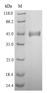 SDS-PAGE- Recombinant protein Zaire NP