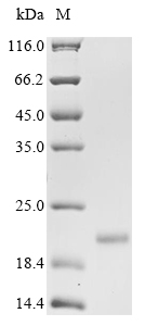 Recombinant Woodchuck hepatitis B virus Protein X (X) - image 1
