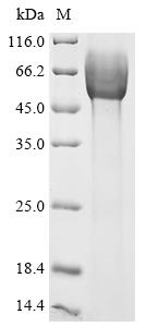 Recombinant Giardia intestinalis Surface antigen CRP170, partial - image 1
