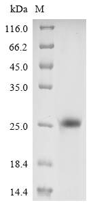 (Tris-Glycine gel) Discontinuous SDS-PAGE (reduced) with 5% enrichment gel and 15% separation gel. (Tris-Glycine gel) Discontinuous SDS-PAGE (reduced) with 5% enrichment gel and 15% separation gel.