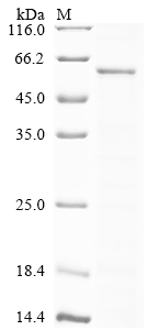 (Tris-Glycine gel) Discontinuous SDS-PAGE (reduced) with 5% enrichment gel and 15% separation gel. (Tris-Glycine gel) Discontinuous SDS-PAGE (reduced) with 5% enrichment gel and 15% separation gel.