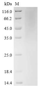 Recombinant Human cytomegalovirus Protein UL16 (UL16) , partial - image 1