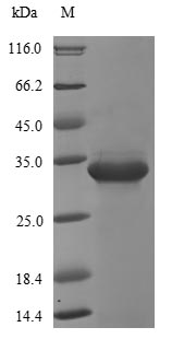 (Tris-Glycine gel) Discontinuous SDS-PAGE (reduced) with 5% enrichment gel and 15% separation gel. (Tris-Glycine gel) Discontinuous SDS-PAGE (reduced) with 5% enrichment gel and 15% separation gel.