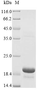 (Tris-Glycine gel) Discontinuous SDS-PAGE (reduced) with 5% enrichment gel and 15% separation gel. (Tris-Glycine gel) Discontinuous SDS-PAGE (reduced) with 5% enrichment gel and 15% separation gel.