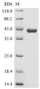 Recombinant Human CAD protein (CAD) , partial - image 1