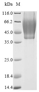 (Tris-Glycine gel) Discontinuous SDS-PAGE (reduced) with 5% enrichment gel and 15% separation gel.