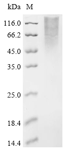 Recombinant Saccharomyces cerevisiae Chromatin assembly factor 1 subunit p60 (CAC2) - image 1