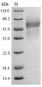 (Tris-Glycine gel) Discontinuous SDS-PAGE (reduced) with 5% enrichment gel and 15% separation gel. (Tris-Glycine gel) Discontinuous SDS-PAGE (reduced) with 5% enrichment gel and 15% separation gel.