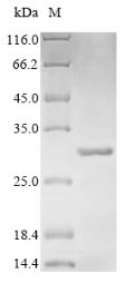 SDS-PAGE- Recombinant protein Escherichia bla