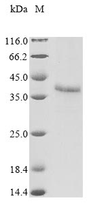 (Tris-Glycine gel) Discontinuous SDS-PAGE (reduced) with 5% enrichment gel and 15% separation gel. (Tris-Glycine gel) Discontinuous SDS-PAGE (reduced) with 5% enrichment gel and 15% separation gel.