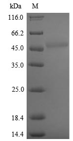 (Tris-Glycine gel) Discontinuous SDS-PAGE (reduced) with 5% enrichment gel and 15% separation gel.