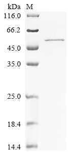 (Tris-Glycine gel) Discontinuous SDS-PAGE (reduced) with 5% enrichment gel and 15% separation gel. (Tris-Glycine gel) Discontinuous SDS-PAGE (reduced) with 5% enrichment gel and 15% separation gel.