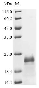 Recombinant Hepatitis delta virus genotype I Small delta antigen - image 1