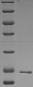 (Tris-Glycine gel) Discontinuous SDS-PAGE (reduced) with 5% enrichment gel and 15% separation gel.
