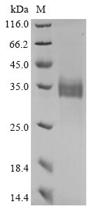 (Tris-Glycine gel) Discontinuous SDS-PAGE (reduced) with 5% enrichment gel and 15% separation gel. (Tris-Glycine gel) Discontinuous SDS-PAGE (reduced) with 5% enrichment gel and 15% separation gel.