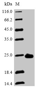 (Tris-Glycine gel) Discontinuous SDS-PAGE (reduced) with 5% enrichment gel and 15% separation gel. (Tris-Glycine gel) Discontinuous SDS-PAGE (reduced) with 5% enrichment gel and 15% separation gel.