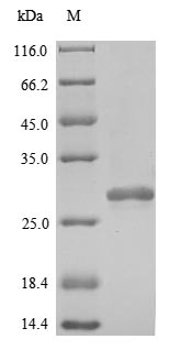 (Tris-Glycine gel) Discontinuous SDS-PAGE (reduced) with 5% enrichment gel and 15% separation gel. (Tris-Glycine gel) Discontinuous SDS-PAGE (reduced) with 5% enrichment gel and 15% separation gel.