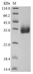 (Tris-Glycine gel) Discontinuous SDS-PAGE (reduced) with 5% enrichment gel and 15% separation gel. (Tris-Glycine gel) Discontinuous SDS-PAGE (reduced) with 5% enrichment gel and 15% separation gel.