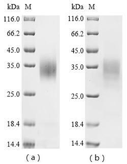 (Tris-Glycine gel) Discontinuous SDS-PAGE (reduced) with 5% enrichment gel and 15% separation gel. (Tris-Glycine gel) Discontinuous SDS-PAGE (reduced) with 5% enrichment gel and 15% separation gel.