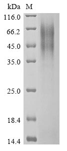 (Tris-Glycine gel) Discontinuous SDS-PAGE (reduced) with 5% enrichment gel and 15% separation gel. (Tris-Glycine gel) Discontinuous SDS-PAGE (reduced) with 5% enrichment gel and 15% separation gel.