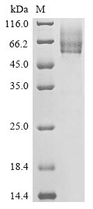 (Tris-Glycine gel) Discontinuous SDS-PAGE (reduced) with 5% enrichment gel and 15% separation gel. (Tris-Glycine gel) Discontinuous SDS-PAGE (reduced) with 5% enrichment gel and 15% separation gel.