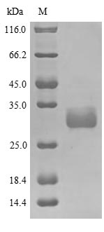 (Tris-Glycine gel) Discontinuous SDS-PAGE (reduced) with 5% enrichment gel and 15% separation gel. (Tris-Glycine gel) Discontinuous SDS-PAGE (reduced) with 5% enrichment gel and 15% separation gel.