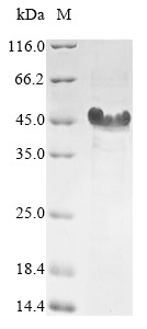 (Tris-Glycine gel) Discontinuous SDS-PAGE (reduced) with 5% enrichment gel and 15% separation gel. (Tris-Glycine gel) Discontinuous SDS-PAGE (reduced) with 5% enrichment gel and 15% separation gel.