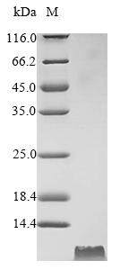 (Tris-Glycine gel) Discontinuous SDS-PAGE (reduced) with 5% enrichment gel and 15% separation gel. (Tris-Glycine gel) Discontinuous SDS-PAGE (reduced) with 5% enrichment gel and 15% separation gel.