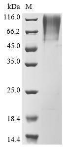 (Tris-Glycine gel) Discontinuous SDS-PAGE (reduced) with 5% enrichment gel and 15% separation gel. (Tris-Glycine gel) Discontinuous SDS-PAGE (reduced) with 5% enrichment gel and 15% separation gel.